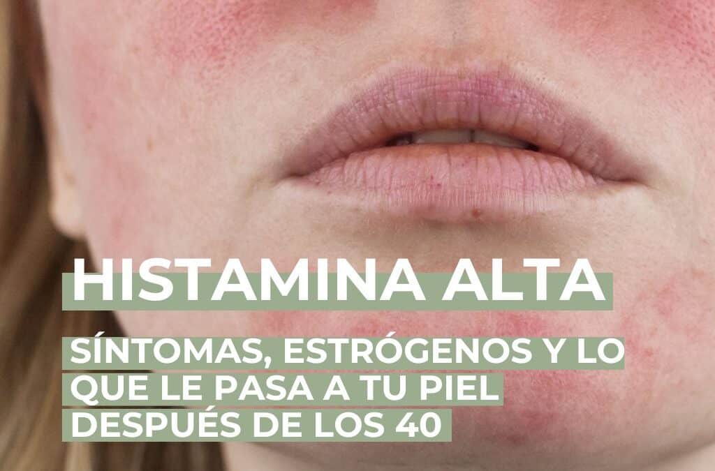 Histamina alta: síntomas, estrógenos y lo que le pasa a tu piel después de los 40