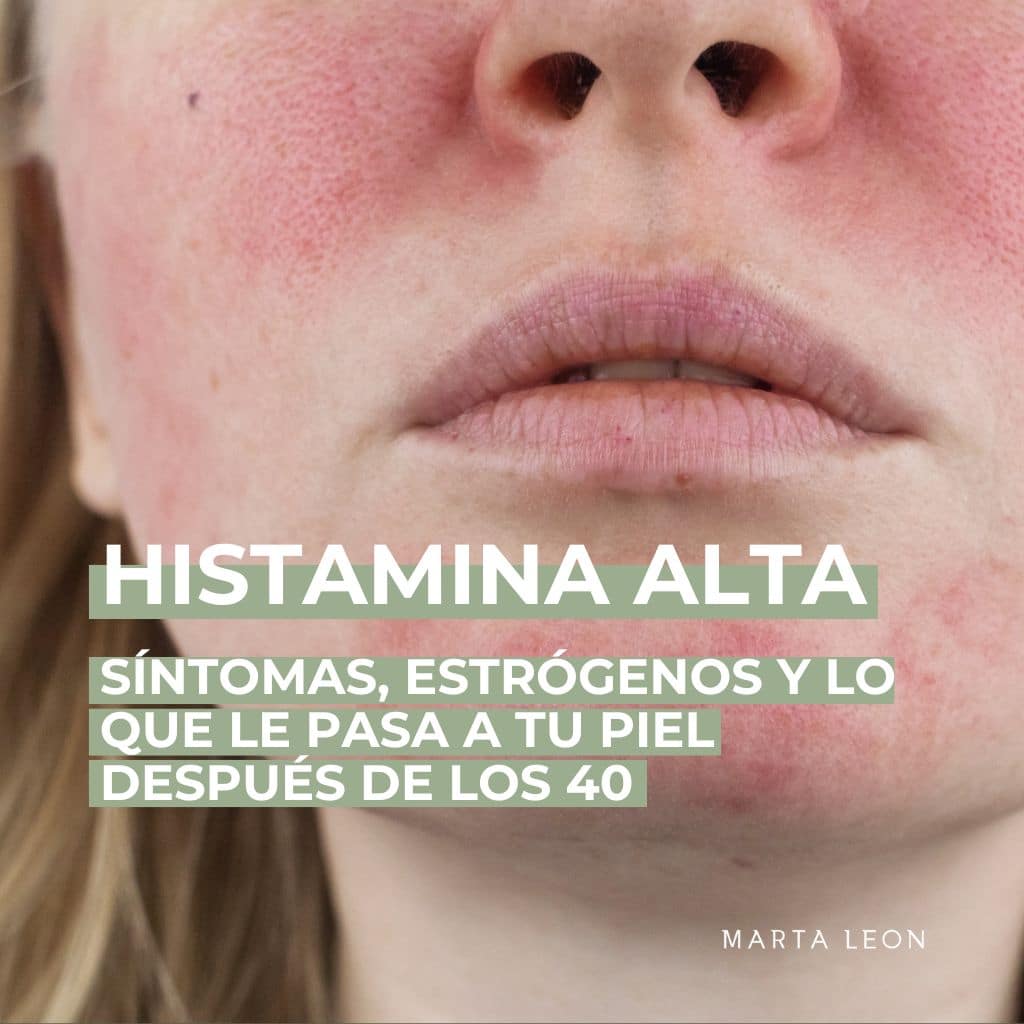 Histamina alta: síntomas, estrógenos y lo que le pasa a tu piel después de los 40