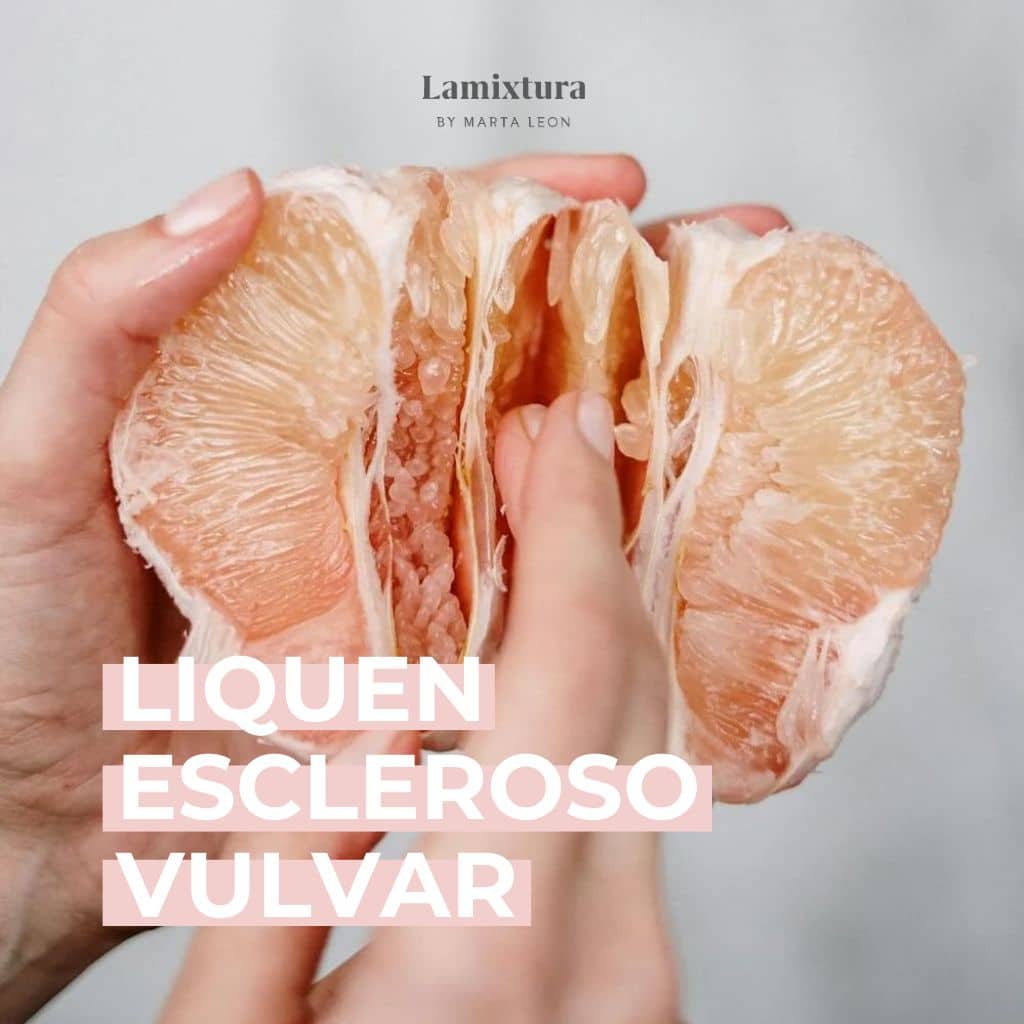 Liquen escleroso vulvar: qué es, síntomas y cómo tratarlo en menopausia